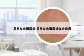 男朋友有银屑病 男朋友有银屑病你会嫁吗