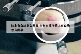 脸上有白块怎么回事 六七岁孩子脸上有白块怎么回事