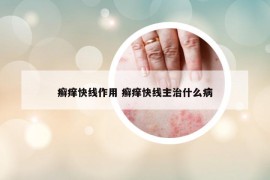 癣痒快线作用 癣痒快线主治什么病