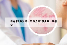 白介素2多少钱一支 白介素2多少钱一支泉奇