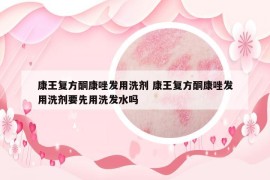 康王复方酮康唑发用洗剂 康王复方酮康唑发用洗剂要先用洗发水吗