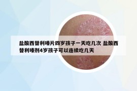 盐酸西替利嗪片四岁孩子一天吃几次 盐酸西替利嗪剂4岁孩子可以连续吃几天