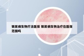 银屑病生物疗法医保 银屑病生物治疗在医保范围吗