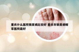 重庆什么医院银屑病比较好 重庆市银屑病哪家医院最好