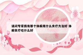 请问专家我有那个体癣用什么食疗方治好 体癣食疗吃什么好