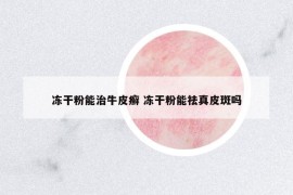 冻干粉能治牛皮癣 冻干粉能祛真皮斑吗