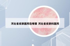 河北省皮肤医院在哪里 河北省皮肤科医院