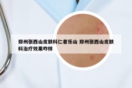 郑州张西山皮肤科仁者乐山 郑州张西山皮肤科治疗效果咋样