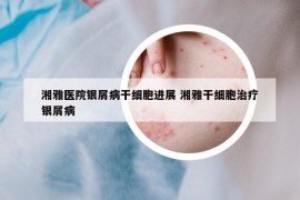 湘雅医院银屑病干细胞进展 湘雅干细胞治疗银屑病