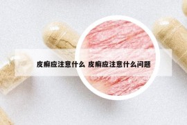 皮癣应注意什么 皮癣应注意什么问题