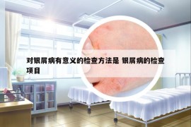 对银屑病有意义的检查方法是 银屑病的检查项目