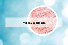 牛皮癣可以做医美吗