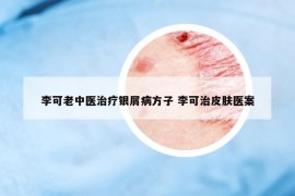 李可老中医治疗银屑病方子 李可治皮肤医案