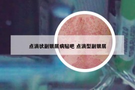 点滴状副银屑病贴吧 点滴型副银屑