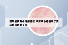 银屑病初期小疙瘩特征 银屑病小疙瘩平了变成片是快好了吗