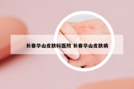 长春华山皮肤科医院 长春华山皮肤病
