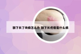 额下长了块癣怎么办 额下长疙瘩是什么病