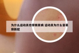 为什么运动员也得银屑病 运动员为什么容易得新冠