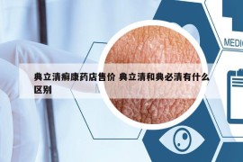 典立清癣康药店售价 典立清和典必清有什么区别