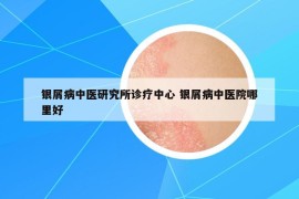 银屑病中医研究所诊疗中心 银屑病中医院哪里好
