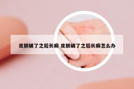 皮肤破了之后长癣 皮肤破了之后长癣怎么办