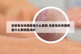 皮肤有白块很痒是什么原因 皮肤有白块很痒是什么原因造成的