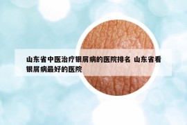 山东省中医治疗银屑病的医院排名 山东省看银屑病最好的医院
