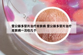 雷公藤多苷片治疗皮肤病 雷公藤多苷片治疗皮肤病一次吃几个