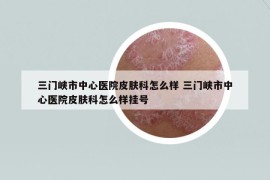 三门峡市中心医院皮肤科怎么样 三门峡市中心医院皮肤科怎么样挂号