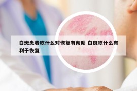 白斑患者吃什么对恢复有帮助 白斑吃什么有利于恢复
