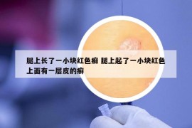 腿上长了一小块红色癣 腿上起了一小块红色上面有一层皮的癣