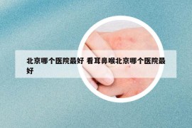 北京哪个医院最好 看耳鼻喉北京哪个医院最好