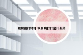 银屑病打钙针 银屑病打针是什么药