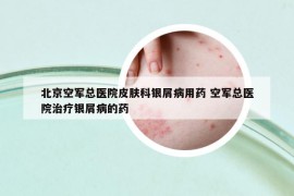 北京空军总医院皮肤科银屑病用药 空军总医院治疗银屑病的药