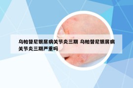 乌帕替尼银屑病关节炎三期 乌帕替尼银屑病关节炎三期严重吗