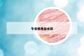 牛皮癣用盐水搽