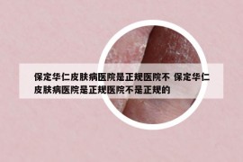 保定华仁皮肤病医院是正规医院不 保定华仁皮肤病医院是正规医院不是正规的