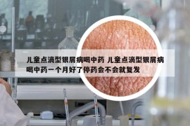 儿童点滴型银屑病喝中药 儿童点滴型银屑病喝中药一个月好了停药会不会就复发