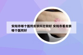 安阳市哪个医院皮肤科比较好 安阳市看皮肤哪个医院好