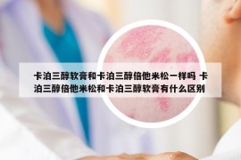 卡泊三醇软膏和卡泊三醇倍他米松一样吗 卡泊三醇倍他米松和卡泊三醇软膏有什么区别