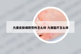 力康皮肤病研究所怎么样 力康医疗怎么样