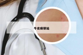 牛皮癣驿站