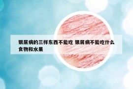 银屑病的三样东西不能吃 银屑病不能吃什么食物和水果