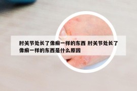 肘关节处长了像癣一样的东西 肘关节处长了像癣一样的东西是什么原因
