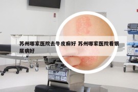 苏州哪家医院去牛皮癣好 苏州哪家医院看银屑病好