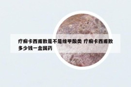 疗癣卡西甫散是不是维甲酸类 疗癣卡西甫散多少钱一盒国药