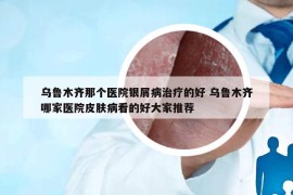 乌鲁木齐那个医院银屑病治疗的好 乌鲁木齐哪家医院皮肤病看的好大家推荐