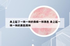 身上起了一块一块的像癣一样黑色 身上起一块一块的黑色斑块