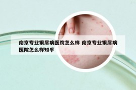 南京专业银屑病医院怎么样 南京专业银屑病医院怎么样知乎
