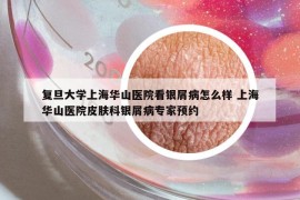 复旦大学上海华山医院看银屑病怎么样 上海华山医院皮肤科银屑病专家预约